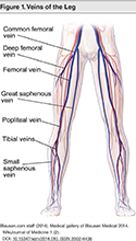 Figure-1-Veins-of-the-Leg