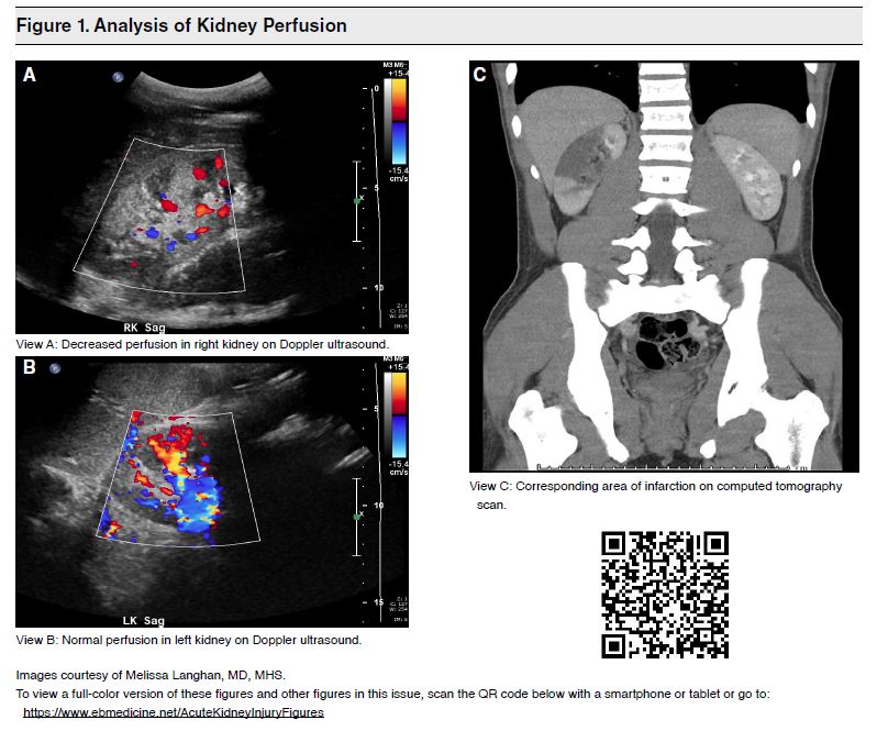 Figure 1. Analysis of Kidney Perfusion