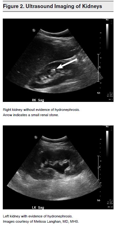Figure 2. Ultrasound Imaging of Kidneys