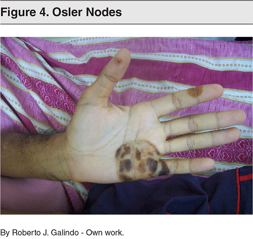 Osler Nodes Xmlinkhub