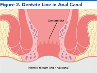 Figure 2. Dentate Line in Anal Canal