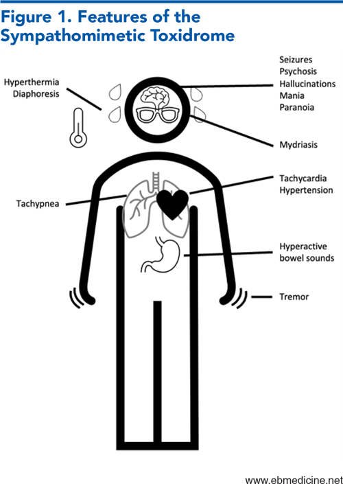 Figure 1. Features of the Sympathomimetic Toxidrome