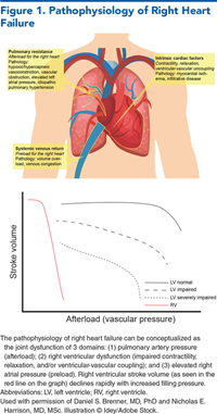 Figure 1. Pathophysiology of Right Heart Failure
