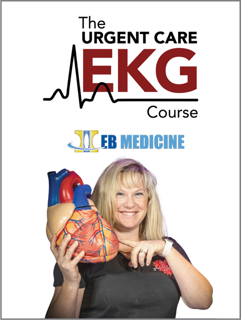 EKG