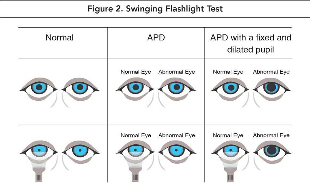 Acute Stroke Care Current Topics