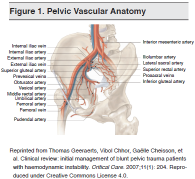 Figure 1. Pelvic Vascular Anatomy