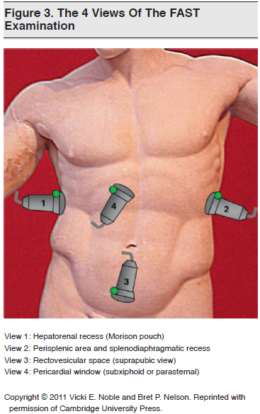 Figure 3_ The 4 Views Of The FAST Examination