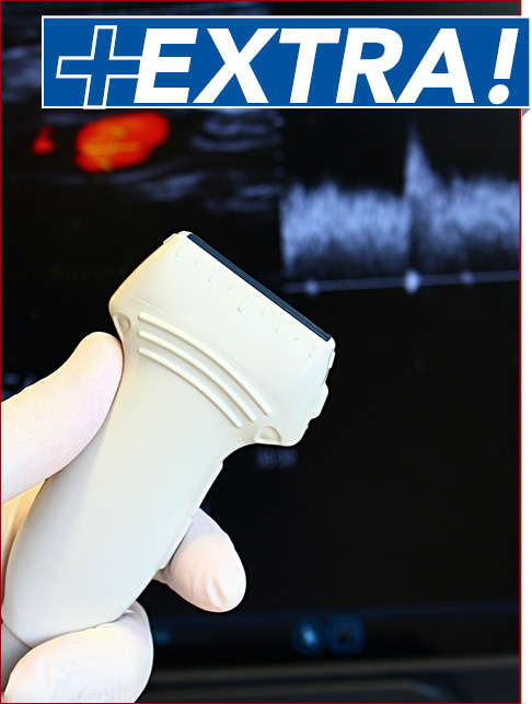 Neurovascular Ultrasound in Acute Stroke: Emergency Department Applications - Stroke EXTRA Supplement (Stroke CME)