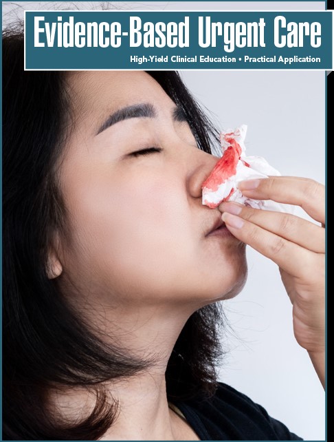Management of Epistaxis in the Urgent Care Setting