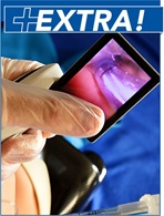 Difficult Airway Management in Trauma: A Review of Current Guidelines - Trauma EXTRA Supplement (Trauma CME)