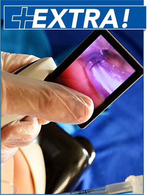 Difficult Airway Management in Trauma: A Review of Current Guidelines - Trauma EXTRA Supplement (Trauma CME)