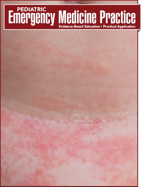 Management of Neonatal Rashes in the Emergency Department (Infectious Disease CME)