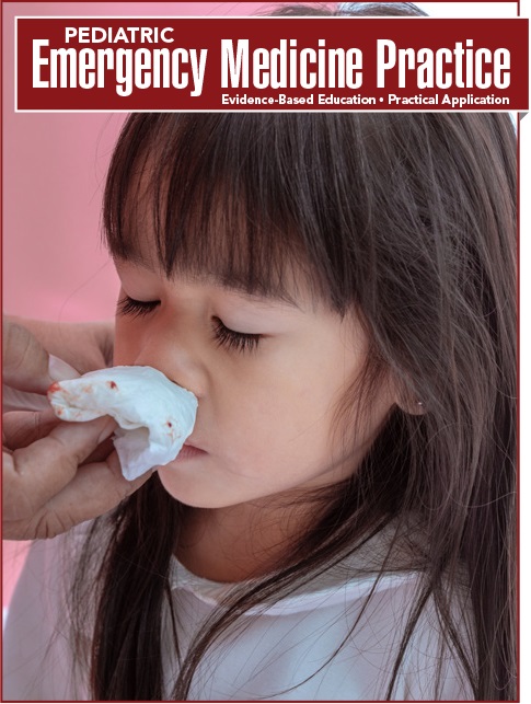 Acute Epistaxis: A Comprehensive Overview in the Acute Care Setting