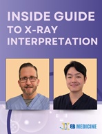 Module 1: Getting Started with X-Rays